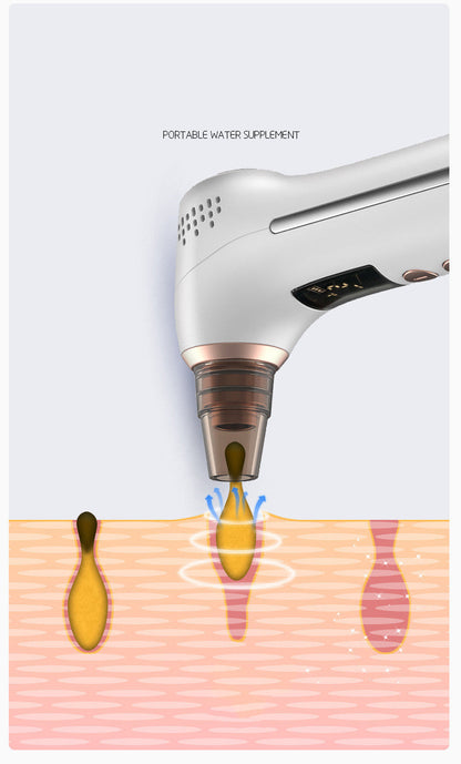 Ice-Hot Blackhead & Acne Removal Facial Cleansing Instrument – Electric Blackhead Extractor